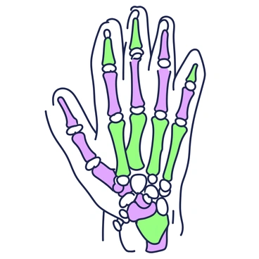 An anatomical illustration of a human hand showing the bones and joints in detail