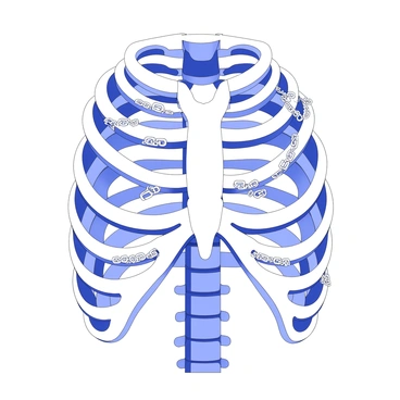 A ribcage is encased in delicate chains, intricately woven around each rib. The chains are thin and ornate, wrapping securely but not tightly, emphasizing the structure of the bones within. The ribcage stands prominently in the center, showcasing the skeletal detail and form. The overall composition suggests an interplay between strength and fragility, with the chains glimmering softly in their meticulous arrangement around the ribcage.