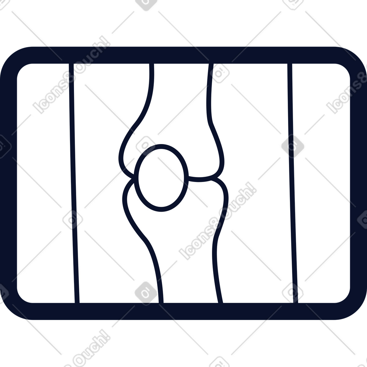 Illustration Scintigraphie des os du genou dans le style Flexy à télécharger aux formats PNG, SVG