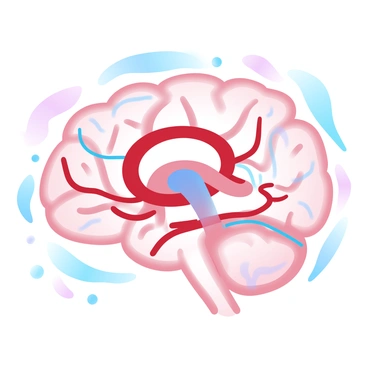 A dynamic illustration showing the blood flow in the brain arteries, with an aneurysm bulge