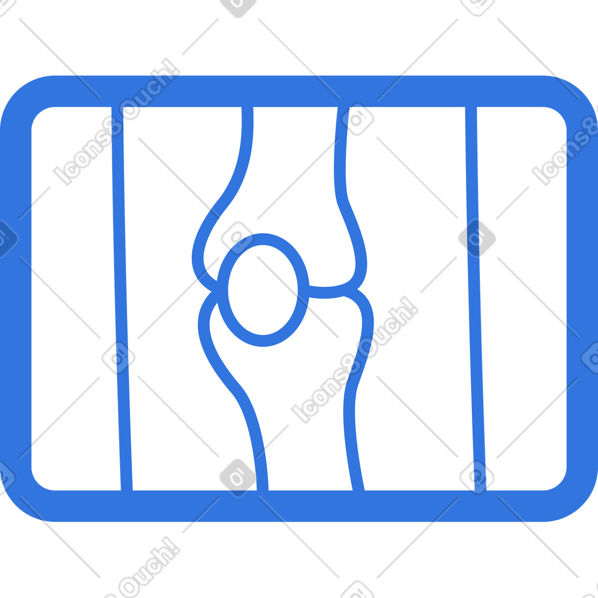 Illustration Scintigraphie des os du genou dans le style Sky à télécharger aux formats PNG, SVG