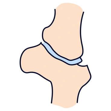 Depiction of ligaments stretching between bones in a joint