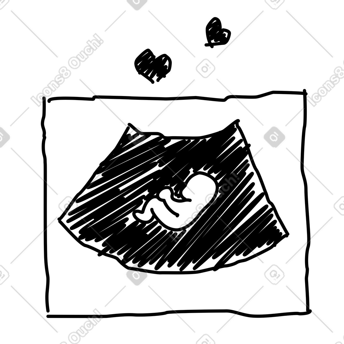 下载 Rough Sketch 风格的 Pregnancy ultrasound screen displaying fetus silhouette and loving hearts above 插画，支持 PNG、SVG 格式
