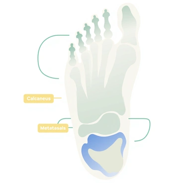 An illustration of the human foot skeleton highlighting the arch structure