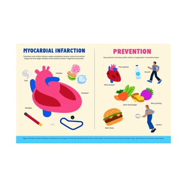 An educational poster about "myocardial infarction." The poster includes multiple sections, each containing clear illustrations. On the left side, there is an illustration showing the "causes" of myocardial infarction, featuring elements like a coronary artery clogged with cholesterol, a cigarette, and a fast-food burger. On the right side, the "prevention" section displays images of a heart with a stethoscope, fruits and vegetables, a person jogging, and a bottle of water. Each illustration is labeled with clear text for easy understanding, using bold and colorful fonts against a light background. The layout is organized, making it easy to follow the information presented.