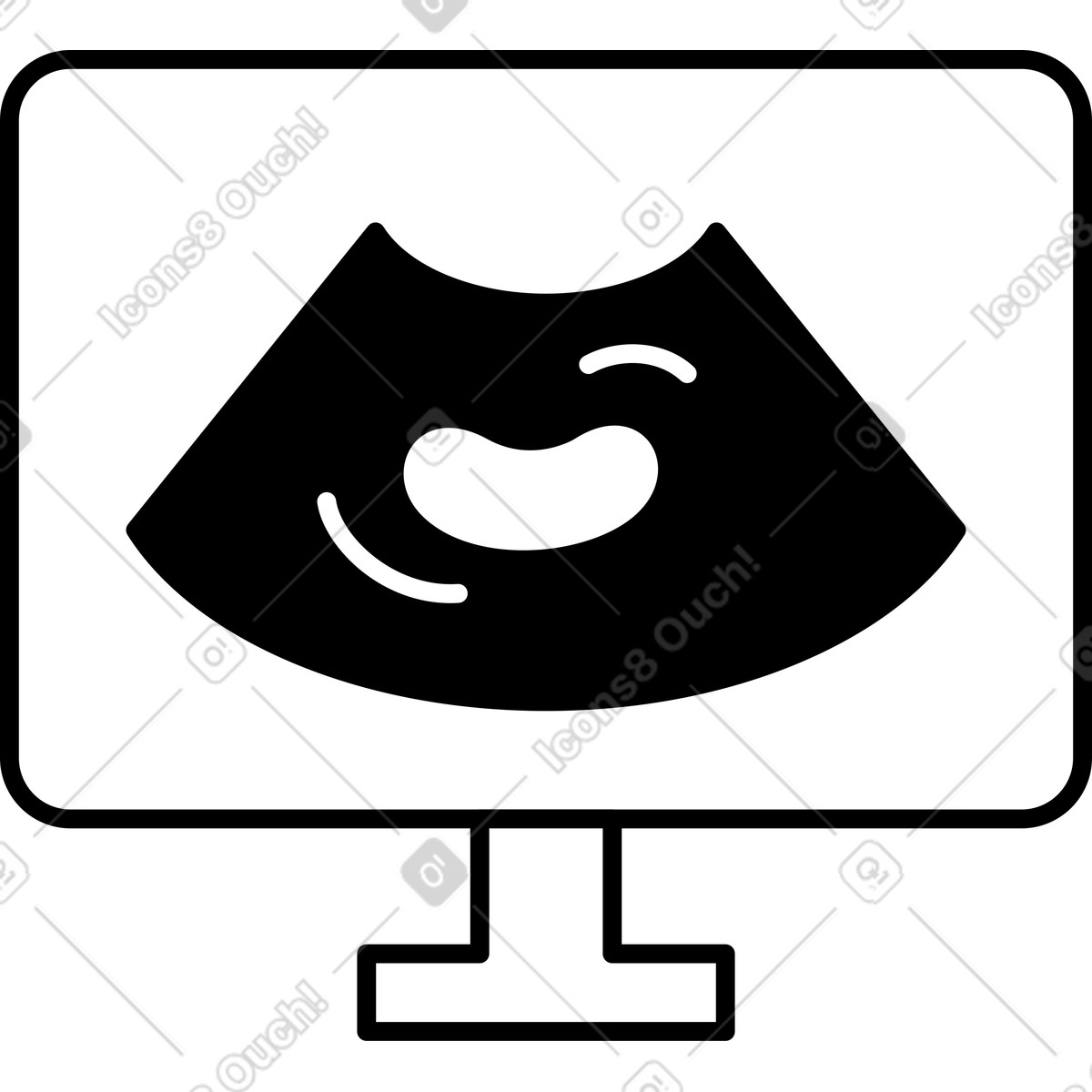 Ultrasound monitor displaying fetus silhouette for prenatal pregnancy examination-Illustration im Notion Line Art-Stil als Download in PNG, SVG
