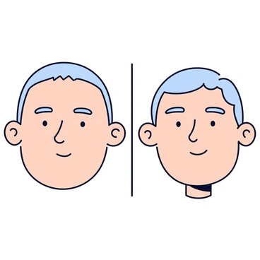 A split image depicting two side-by-side photos of a rhinoplasty patient. On the left side, the patient has a nose with a slightly wider bridge and a more pronounced tip. On the right side, the patient's nose appears more refined with a narrower bridge and a softer tip. The patient has a neutral expression in both images, and the background is minimalistic and plain to keep the focus on the nose.