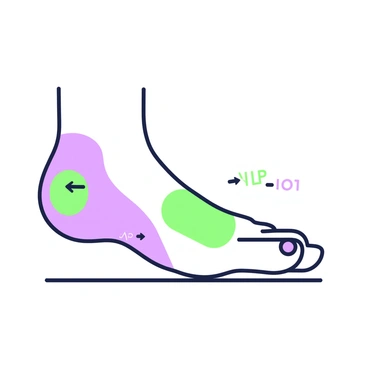 An illustration of a foot displayed from the side, showing the contours and details of the skin. The foot is positioned horizontally, with the toes slightly curled. Highlighted areas on the foot are marked in a distinct way, indicating common sore spots for diabetics. These areas include the heel, ball of the foot, and the tips of the toes. Small arrows point to each highlighted area, providing clarity on their locations. The background is minimal to keep the focus on the foot and highlighted sections.