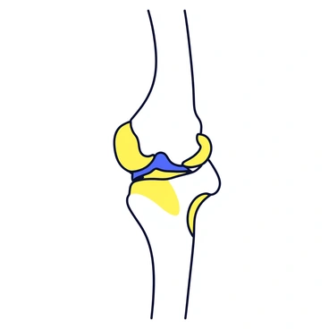 An illustration of a dog's knee joint. The knee joint is shown in detail, highlighting the "hyaline cartilage" that covers the surfaces of the bones. The joint includes the femur and tibia, clearly displaying the smooth texture of the "hyaline cartilage." The surrounding ligaments and tendons are also visible, providing context to the joint's structure.