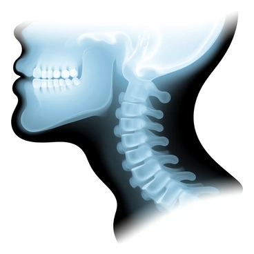 An X-ray style image focusing on the trachea within the neck's structure